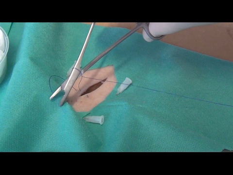 Kaufen Implantate für Hüfte Orthese für Hüft-Bewertungen