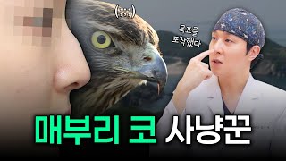 매부리 코 성형 전 필수시청!
