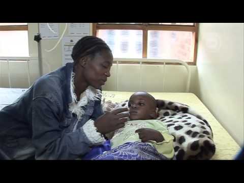 Comment reconnaître les signes de pneumonie