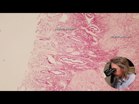 Histology of the uterus