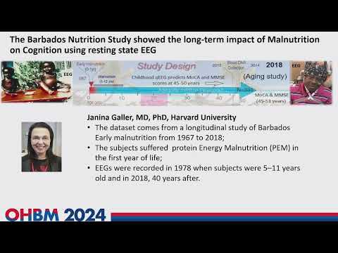 OHBM 2024 | Educational Course | Global Open Science Electrophysiology | Part 8