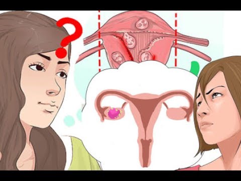 Behandlung von Prostatitis Israel Prostatitis normaler Hund