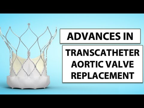 Patient Webinar: Advances in Transcatheter Aortic Valve Replacement (TAVR)