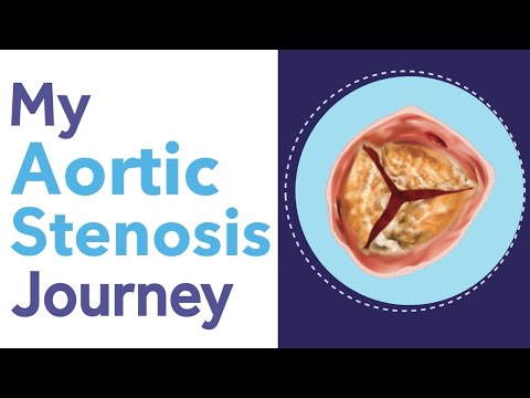 Diagnosed with Aortic Stenosis - What Now?