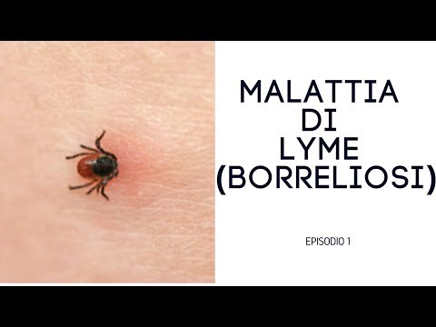 Trattamento dellosteoartrosi m Dolore allanca di striscio