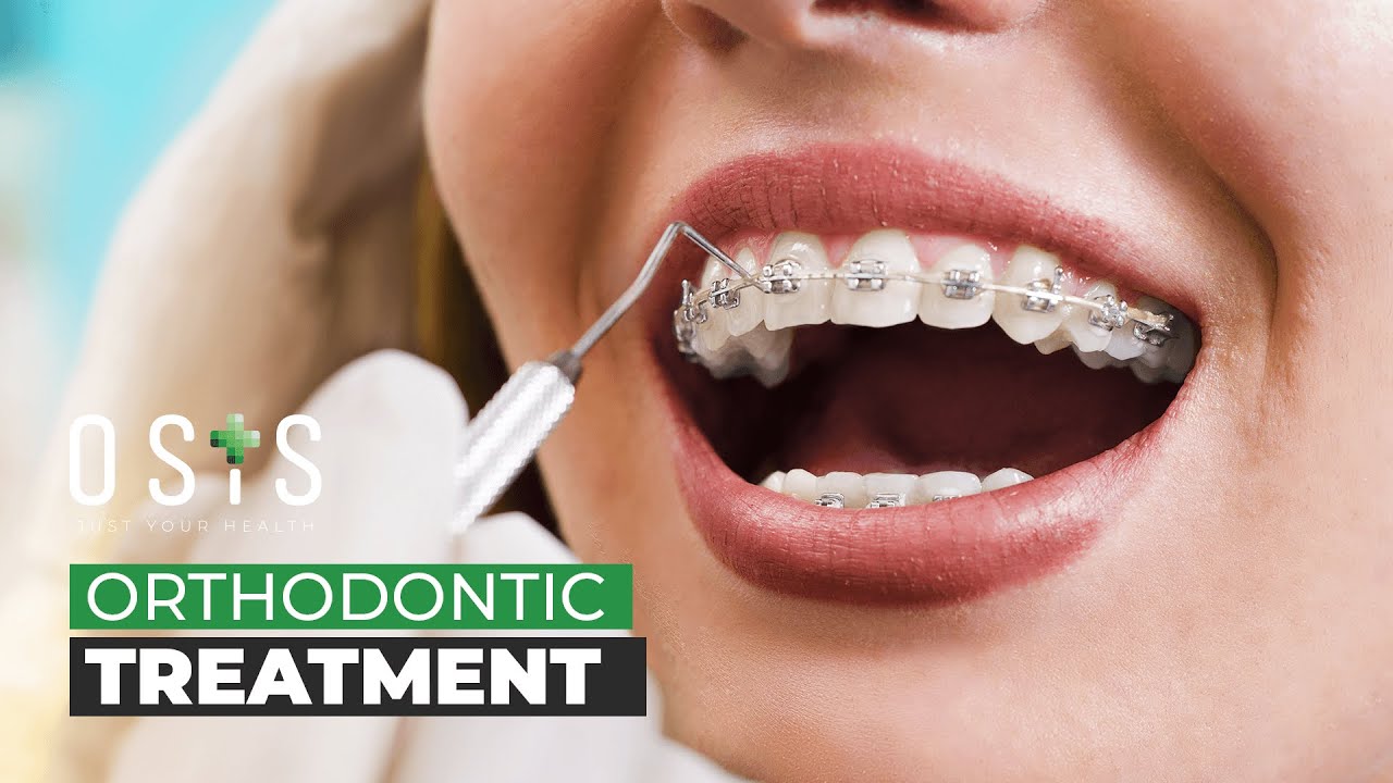 Orthodontic Treatment