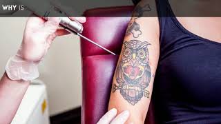 How Laser Hair Removal Affects Tattoos?