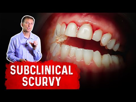 8 Signs of a Vitamin C Deficiency You ve Never Heard About