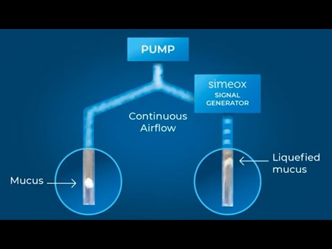 What is the principle of use of the Simeox - PhysioAssist