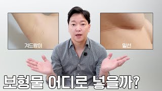 가슴성형 보형물 삽입 위치 어디로? #디테성형외과 #이준욱원장