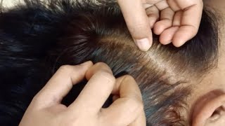 🌙✨ ASMR - Relaxing Scalp Check & Scalp Treatment , Tingles (Real Person), Scratching #sleep #asmr