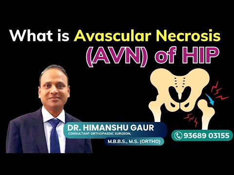 Hip Pain Issues video thumbnail