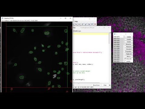 Cellpose + counting frame 2D