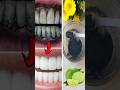 Teeth whitening naturally at home with charcoal
