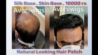 Skin Base Men hair wig in delhi