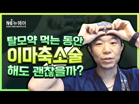 탈모약 먹는 동안 이마축소술 해도 괜찮을까? - 뉴헤어 I 헤어라인