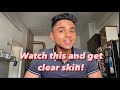 Follow these steps to get clear glowing skin! (my skin care routine)
