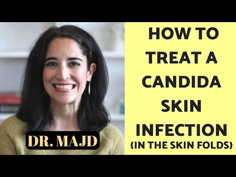 Treatment of Fungus in the Folds