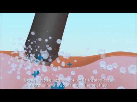 The OxyGeneo(TM) 3-in-1 Super-Facial