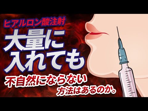 医学科 ヒアルロン酸注射、大量に入れても不自然にならない方法はあるのか。