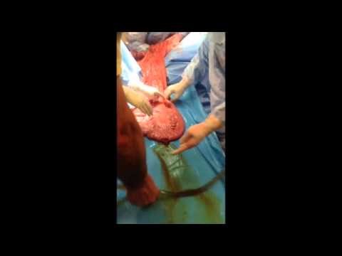 YouTube video about: How to prevent enteroliths in horses?