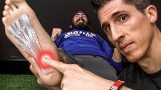 Como Solucionar la Fascitis Plantar ¡NO MÁS DOLOR DE TALÓN!