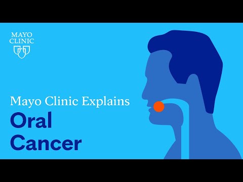 Mayo Clinic Explains Oral Cancer