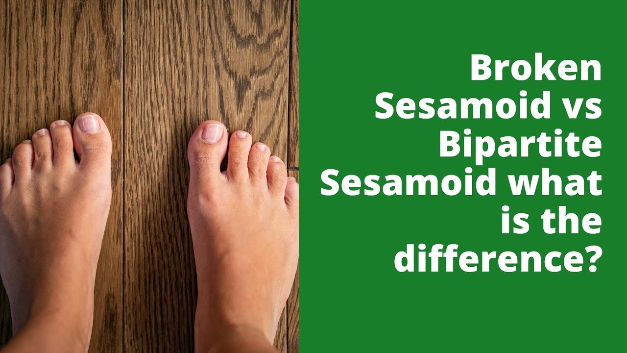 Broken Sesamoid vs Bipartite Sesamoid what is the difference?