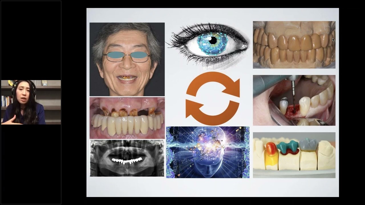 BEGO Implant Systems – All on X – Diving in digital dental diva