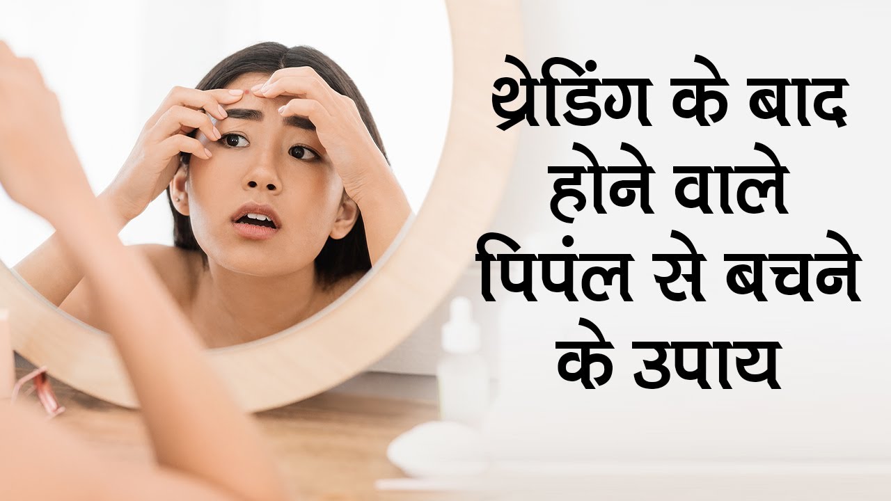 4 Useful Ways To Treat Pimples After Threading