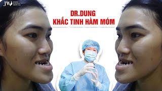 CỰC HOT Bác sĩ Tú Dung lần đầu CÔNG BỐ bí kíp Phẫu thuật hàm móm, đảm bảo 100% biến XẤU thành ĐẸP
