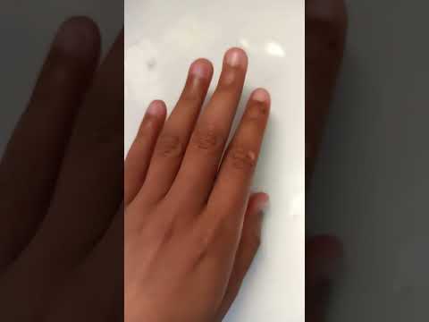 Nail growth journey day 2 #trending #viral #shorts #nailgrowth