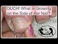 Pedicure Tutorial What Mimics Ingrown Toenail Pain Pro Tools Available On My Online Store ️