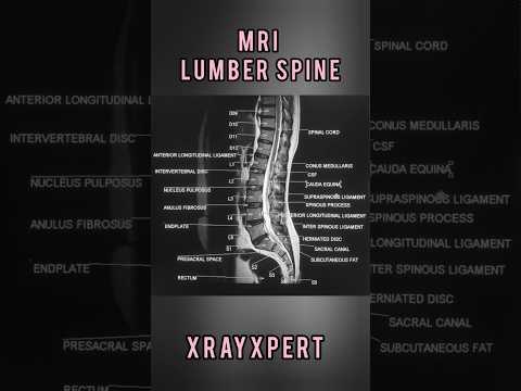 Lumbar Spine MRI (Sagittal View) with Detailed Labeling.#XrayXpert #MRI #SpineAnatomy #Radiology