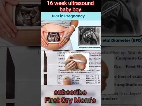 what is BPD in ultrasound report #pregnancy #pregnancytips  #ultrasound #bpd #anomaly #scan #shorts