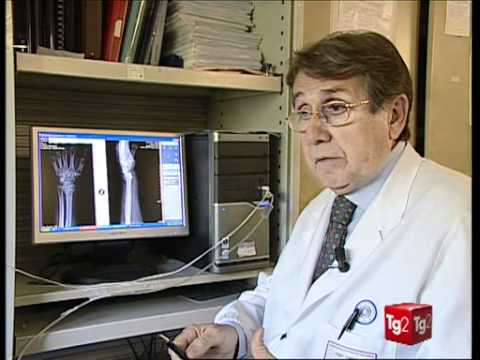 Lo scricchiolio delle articolazioni è Perdita di tazza del giunto