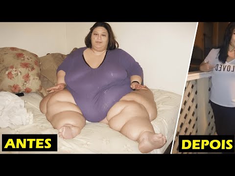 She was THE HEAVIEST WOMAN IN THE WORLD and after WEIGHT LOSS she is LIKE THIS!