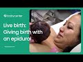 Live Birth Epidural