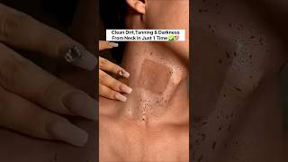 ✅️ Neck Cleaning Tips | Dark Neck  Home Remedies/Tanning Removal Tips 😱#beauty#skincare#shorts#viral