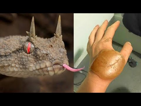 20 Most Painful Snake Bites In The World