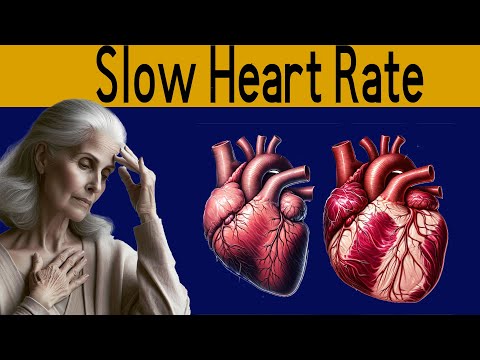 Bradycardia - Top 5 most common cause of Slow Heart Rate
