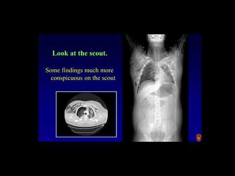 Imaging thoracoabdominal and spinal trauma