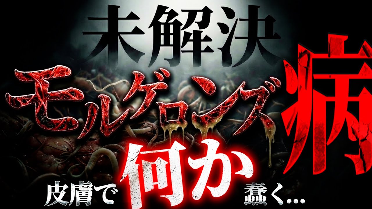 現実か妄想か？未解決論争「モルゲロンズ病」