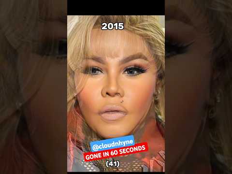 Lil’ Kim’s Plastic Surgery Timeline Will Leave You Speechless
