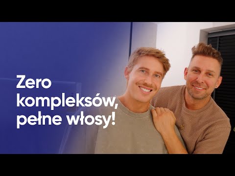 2 lata po przeszczepie włosów – efekty Dawida i Łukasza | Cosmedica Clinic dr. Acar