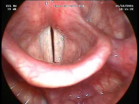 les cordes vocales :  larynx
