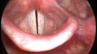 les cordes vocales :  larynx