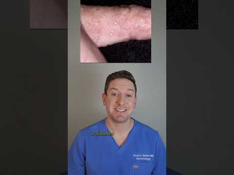 Derm's #1 tip for itchy finger bumps: Dyshidrotic Eczema #derm #fingerbumps #whatsonmyskin