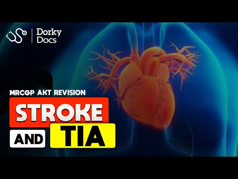 Stroke & TIA - The MRCGP AKT Exam Revision I Dorky Docs