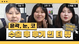 성형외과 직원이 직접 윤곽, 눈, 코 수술을 하고 말해주는 후기 수술 5일차, 3주 차, 3개월 차 공개!!!!!